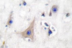 Image no. 2 for anti-Solute Carrier Family 2 (Facilitated Glucose Transporter), Member 3 (SLC2A3) antibody (ABIN265443)