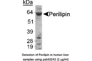 Image no. 1 for anti-Perilipin 1 (PLIN1) (C-Term) antibody (ABIN363551) (PLIN1 抗体  (C-Term))