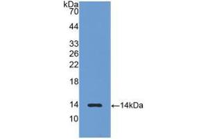 Western blot analysis of recombinant Rat LHb. (LHB 抗体  (AA 21-141))