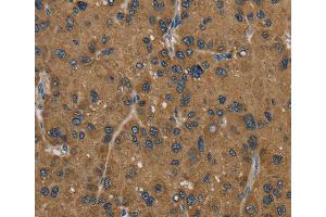 Immunohistochemistry (IHC) image for anti-Hydroxysteroid (17-Beta) Dehydrogenase 2 (HSD17B2) antibody (ABIN2430252) (HSD17B2 抗体)