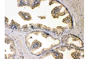 IHC analysis of DBI using anti-DBI antibody . (Diazepam Binding Inhibitor 抗体  (AA 2-87))