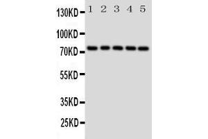 Western Blotting (WB) image for anti-Heat Shock 70kDa Protein 9 (Mortalin) (HSPA9) (AA 591-609), (C-Term) antibody (ABIN3043052) (HSPA9 抗体  (C-Term))