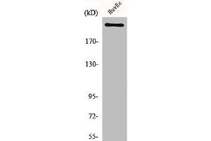 Western Blot analysis of HuvEc cells using Na+ CP-pan Polyclonal Antibody (SCN1A/SCN2A/SCN3A/SCN4A/SCN5A/SCN8A/SCN9A/SCN1A/SCN11A (Internal Region) 抗体)
