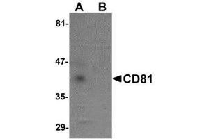 Western blot analysis of CD81 in human lung tissue lysate with AP30217PU-N CD81 antibody at 1 μg/ml in (A) the absence and (B) the presence of blocking petide. (CD81 抗体  (N-Term))