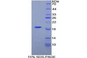 SDS-PAGE analysis of Rat alpha Lactalbumin Protein. (LALBA 蛋白)