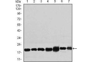 Western blot analysis using RPL18A mouse mAb against NIH3T3 (1), HEK293 (2), HL60 (3), Jurkat (4), Raji (5), MOLT4 (6), and HeLa (7) cell lysate. (RPL18A 抗体  (AA 50-176))