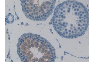 Detection of TACR2 in Rat Testis Tissue using Polyclonal Antibody to Tachykinin Receptor 2 (TACR2) (TACR2 抗体  (AA 1-200))