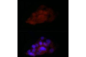 Immunofluorescence analysis of HepG2 cells using TI Rabbit pAb (2523) at dilution of 1:100 (40x lens). (TIA1 抗体  (C-Term))