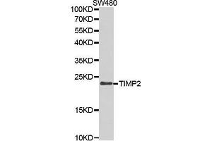 Western blot analysis of extracts of SW480 cell lines, using TIMP2 antibody. (TIMP2 抗体  (AA 100-200))