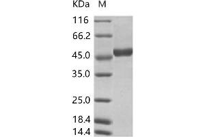 Western Blotting (WB) image for Zika Virus NS1 (ZIKV NS1) protein (His tag) (ABIN7198757) (ZIKV NS1 Protein (His tag))