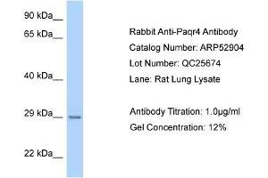Western Blotting (WB) image for anti-Progestin and AdipoQ Receptor Family Member IV (PAQR4) (C-Term) antibody (ABIN2785146) (PAQR4 抗体  (C-Term))
