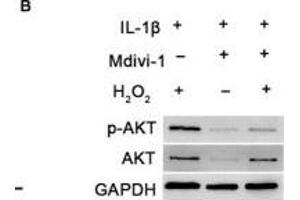 DNM1L deficiency reduces ROS production and autophagy in FLS. (GAPDH 抗体)