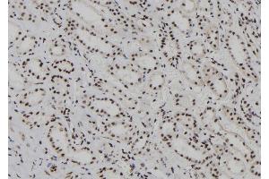 ABIN6262196 and ABIN6278236 at 1/100 staining Human kidney tissue by IHC-P. (HDLBP 抗体  (N-Term))