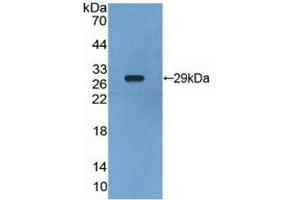 Western blot analysis of recombinant Human RXRg. (Retinoid X Receptor gamma 抗体  (AA 12-220))