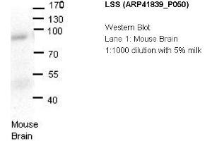 Image no. 1 for anti-Lanosterol Synthase (2,3-Oxidosqualene-Lanosterol Cyclase) (LSS) (N-Term) antibody (ABIN2777020) (LSS 抗体  (N-Term))