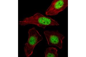 Fluorescent image of A549 cell stained with PURB Antibody (C-term) . (PURB 抗体  (C-Term))