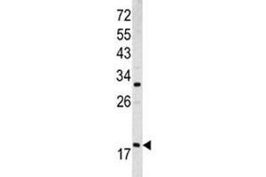 Western blot analysis of ARF3 antibody and MCF-7 lysate (ARF3 抗体  (AA 78-106))