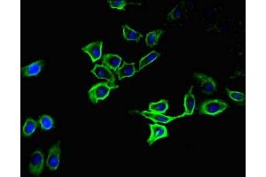 Immunofluorescent analysis of A549 cells using ABIN7170036 at dilution of 1:100 and Alexa Fluor 488-congugated AffiniPure Goat Anti-Rabbit IgG(H+L) (ATP1A1 抗体  (AA 225-407))