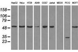 Western blot analysis of extracts (35 µg) from 9 different cell lines by using anti-SLC2A5 monoclonal antibody. (SLC2A5 抗体)