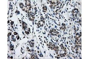 Immunohistochemical staining of paraffin-embedded breast tissue using anti-GRIPAP1 mouse monoclonal antibody. (GRIPAP1 抗体)