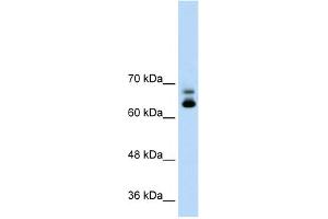 WB Suggested Anti-MTA2 Antibody Titration:  1. (MTA2 抗体  (C-Term))