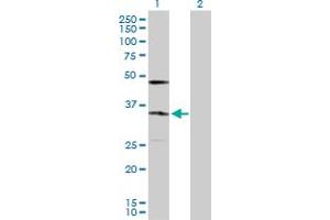 Western Blot analysis of KDELR2 expression in transfected 293T cell line by KDELR2 MaxPab polyclonal antibody. (KDELR2 抗体  (AA 1-212))