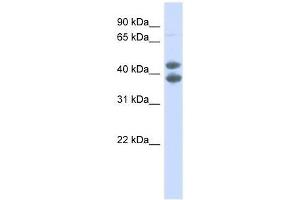 Western Blot showing SOX4 antibody used at a concentration of 1. (SOX4 抗体  (N-Term))