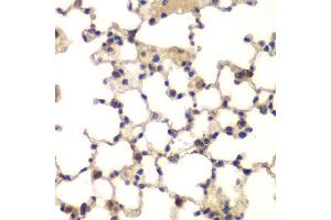 Immunohistochemistry of paraffin-embedded mouse lung using CXXC1 antibody at dilution of 1:200 (40x lens). (CXXC1 抗体)