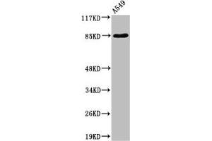 Western Blot analysis of A549 cells using ADAM10 Polyclonal Antibody (A Disintegrin and Metallopeptidase Domain 1a (ADAM1A) (Internal Region) 抗体)