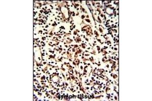 Immunohistochemistry (Paraffin-embedded Sections) (IHC (p)) image for anti-KIAA0226 (KIAA0226) (AA 241-271), (N-Term) antibody (ABIN388583)