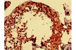 Immunohistochemistry analysis of human testis tissue using ABIN7166460 at dilution of 1:100 (PARK7/DJ1 抗体  (AA 1-188))