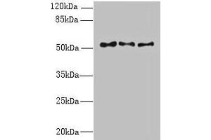 Western blot All lanes: TRIML1 antibody at 3 μg/mL Lane 1: Mouse kidney tissue Lane 2: Human placenta tissue Lane 3: A431 whole cell lysate Secondary Goat polyclonal to rabbit IgG at 1/10000 dilution Predicted band size: 54 kDa Observed band size: 54 kDa (TRIML1 抗体  (AA 277-468))