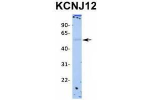 Western Blotting (WB) image for anti-Potassium Inwardly-Rectifying Channel, Subfamily J, Member 12 (KCNJ12) (Middle Region) antibody (ABIN2776235)