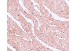Immunohistochemical staining of mouse heart tissue with MTUS2 polyclonal antibody  at 5 ug/mL dilution.