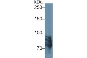 Western blot analysis of Human BXPC3 cell lysate, using Human POSTN Antibody (1 µg/ml) and HRP-conjugated Goat Anti-Rabbit antibody ( (Periostin 抗体  (AA 500-630))