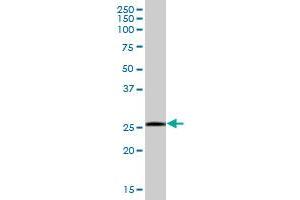 SSPN MaxPab polyclonal antibody. (SSPN 抗体  (AA 1-243))