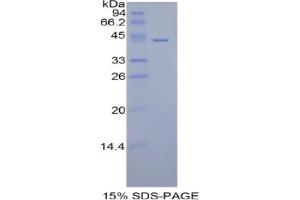 SDS-PAGE analysis of Human HIST1H2AA Protein. (HIST1H2AA 蛋白)