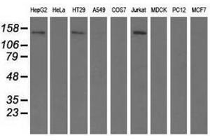 Image no. 2 for anti-Histone Deacetylase 6 (HDAC6) antibody (ABIN1498621) (HDAC6 抗体)
