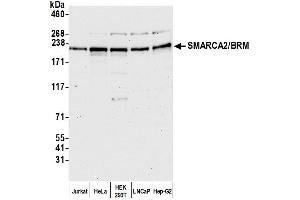 Western Blotting (WB) image for anti-SWI/SNF Related, Matrix Associated, Actin Dependent Regulator of Chromatin, Subfamily A, Member 2 (SMARCA2) (AA 100-150) antibody (ABIN7452045)