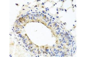 Immunohistochemistry of paraffin-embedded Mouse lung using MUC16 Polyclonal Antibody at dilution of 1:100 (40x lens). (MUC16 抗体)