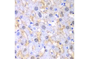 Immunohistochemistry of paraffin-embedded human liver injury using FAH antibody. (FAH 抗体)