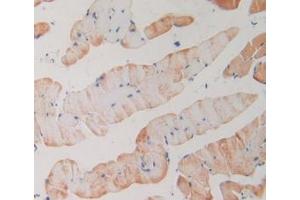 IHC-P analysis of Mouse Skeletal Muscle Tissue, with DAB staining. (PLA2R1 抗体  (AA 1418-1487))