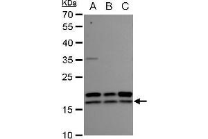 WB Image nm23-H2 antibody detects nm23-H2 protein by western blot analysis. (NME2 抗体  (Center))