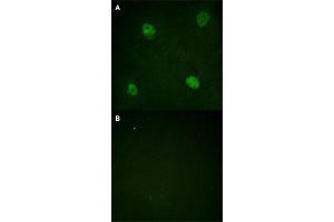 Immunofluorescence staining of methanol-fixed HeLa cells with HNRNPD (phospho S83) polyclonal antibody  without blocking peptide (A) or preincubated with blocking peptide (B) at 1:100-1:200 dilution. (HNRNPD/AUF1 抗体  (pSer83))