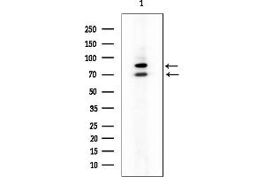 anti-Acyl-CoA Dehydrogenase Family, Member 9 (ACAD9) (Internal Region) antibody