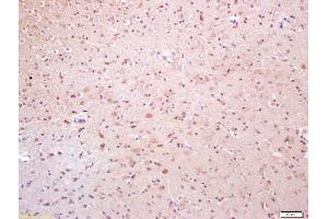 Immunohistochemistry (IHC) image for anti-Nuclear Receptor Subfamily 2, Group C, Member 2 (NR2C2) (pThr184) antibody (ABIN746303)
