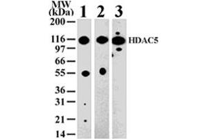 Western blot analysis of HDAC5 in 293 (lane 1) , Jurkat (lane 2) and NIH-3T3 (lane 3) cell lysate with HDAC5 polyclonal antibody  . (HDAC5 抗体  (AA 572-587))