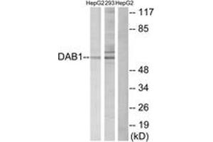 Western blot analysis of extracts from HepG2/293 cells, using Dab1 (Ab-232) Antibody. (DAB1 抗体  (AA 199-248))