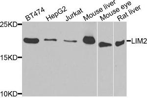 Western blot analysis of extracts of various cell lines, using LIM2 antibody. (LIM2 抗体)