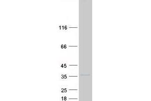 Western Blotting (WB) image for Solute Carrier Family 25, Member 33 (SLC25A33) protein (Myc-DYKDDDDK Tag) (ABIN2732163)